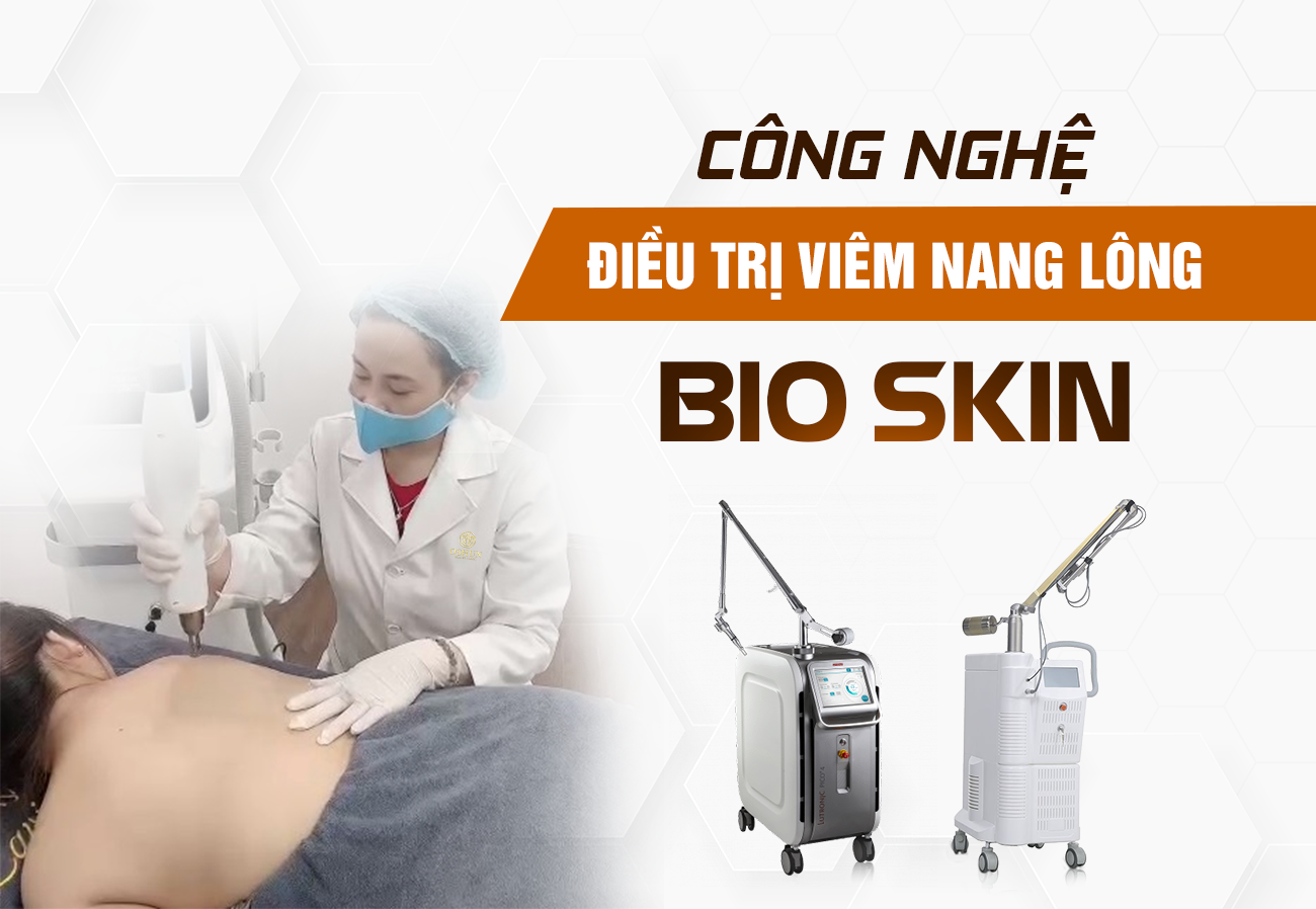 Điều Trị Viêm Nang Lông Bằng Laser Tại Oshun Biên Hòa