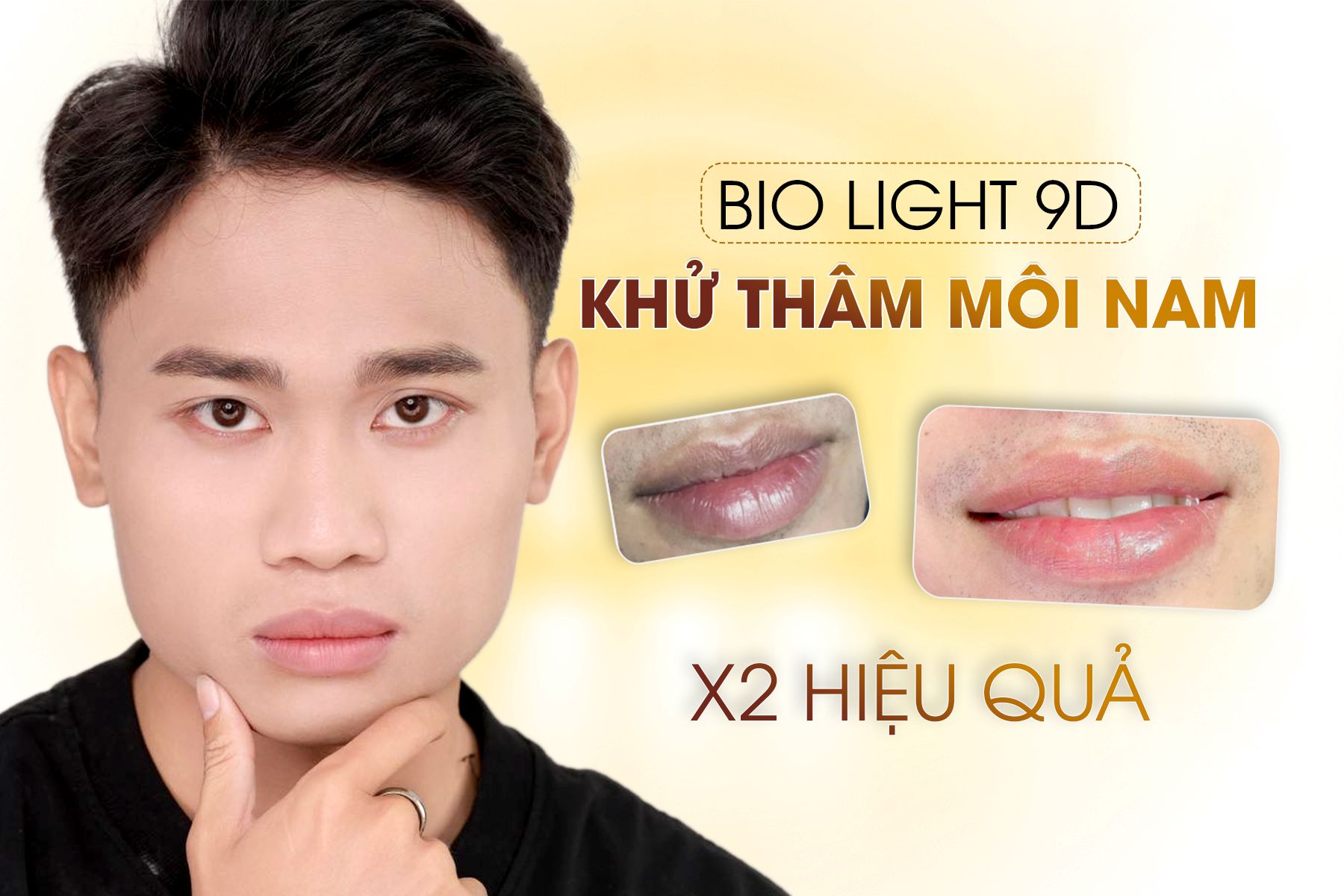 KHỬ THÂM MÔI BIO LIGHT 9D NAM ĐÁNH BẬT LÀN MÔI THÂM SẠM