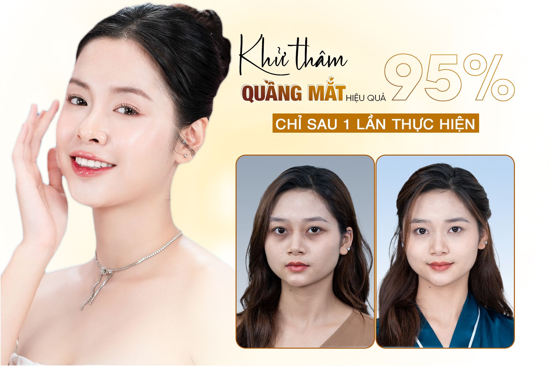 Cấy Tinh Chất Thâm Quầng Mắt Hàn