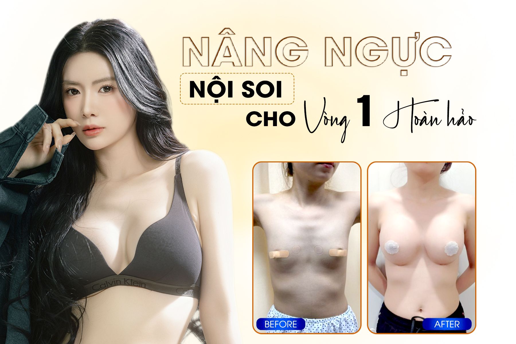 Nâng Ngực Nội Soi Cho Vòng Một Hoàn Hảo 