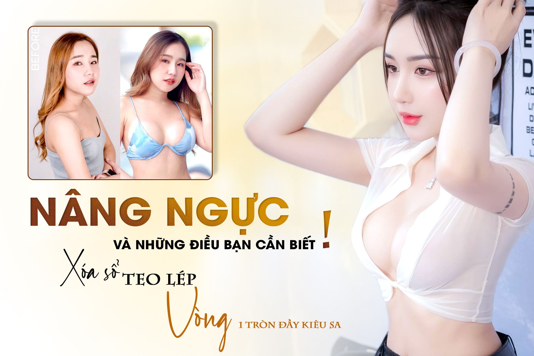  Nâng Ngực Và Những Điều Bạn Cần Biết