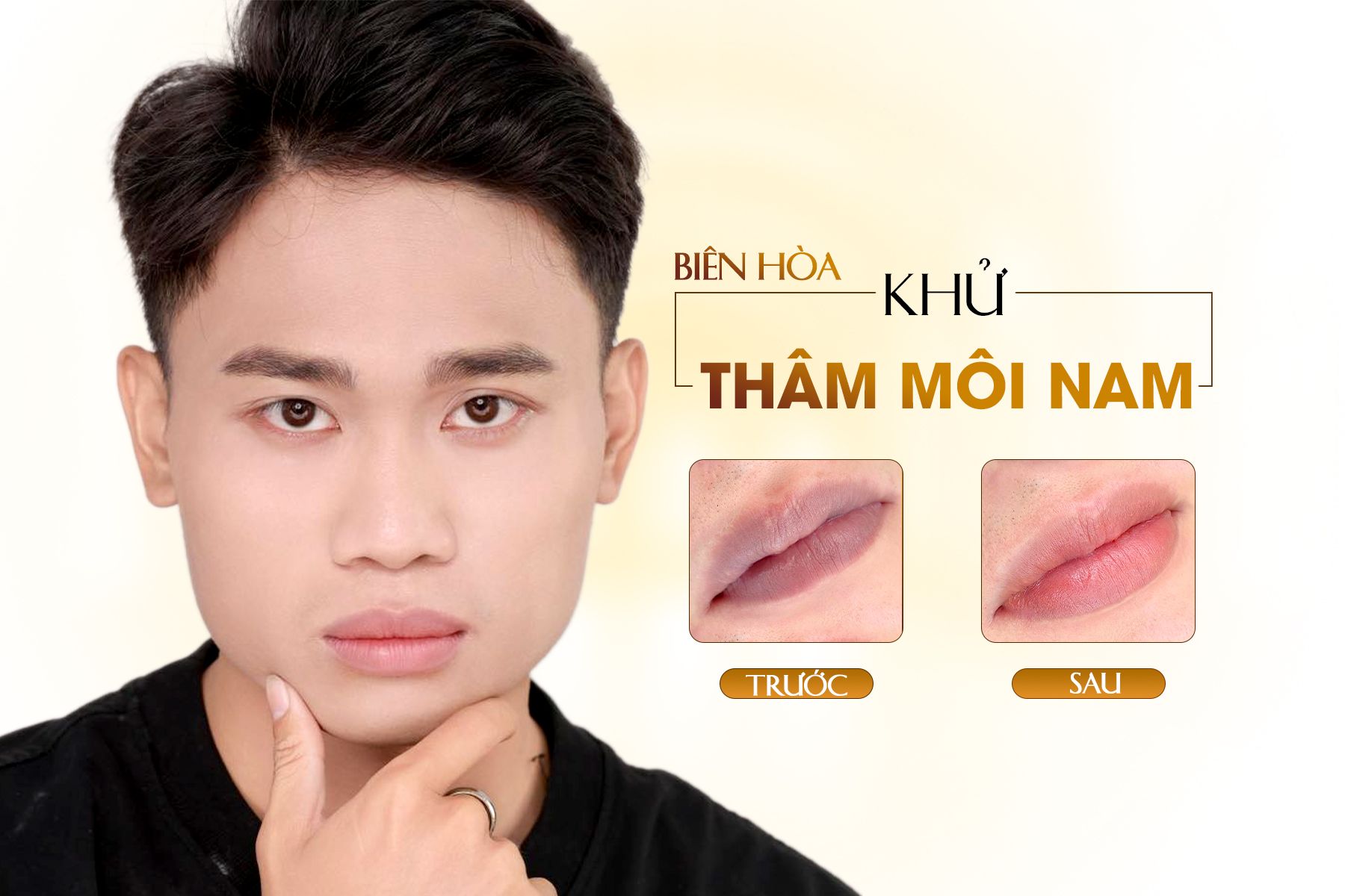 Địa Điểm Khử Thâm Môi Nam Biên Hòa