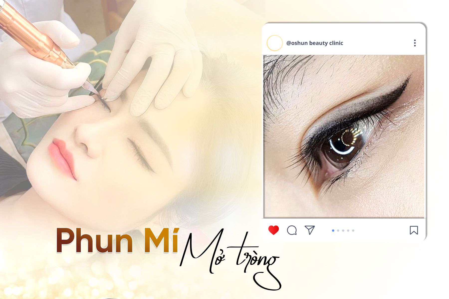 Phun Mí Mở Tròng Hiện Đại 