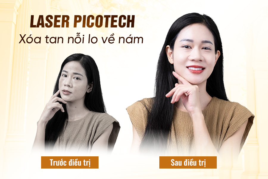 kết quả trước và sau khi điều trị