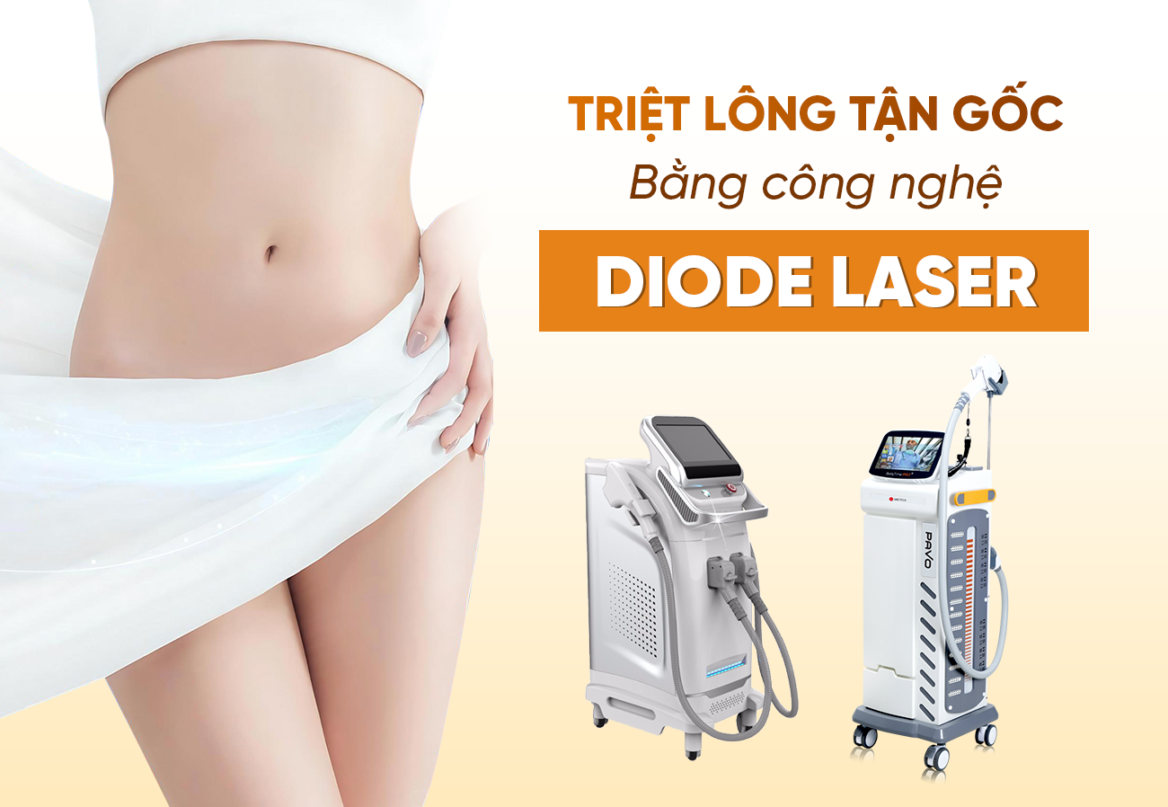 Triệt Lông Vĩnh Viễn Bằng Công Nghệ Diode Laser - Tại Biên Hòa