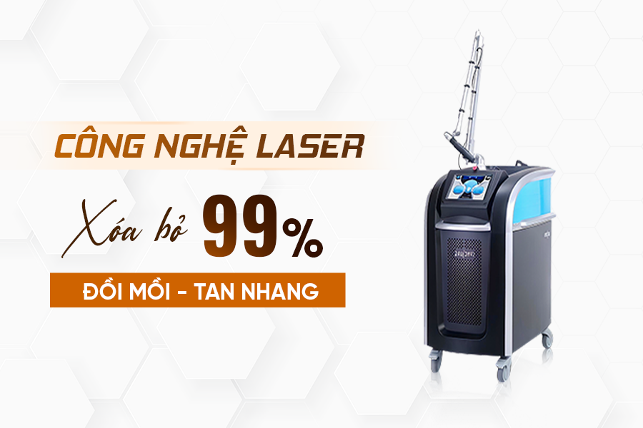 công nghệ Laser