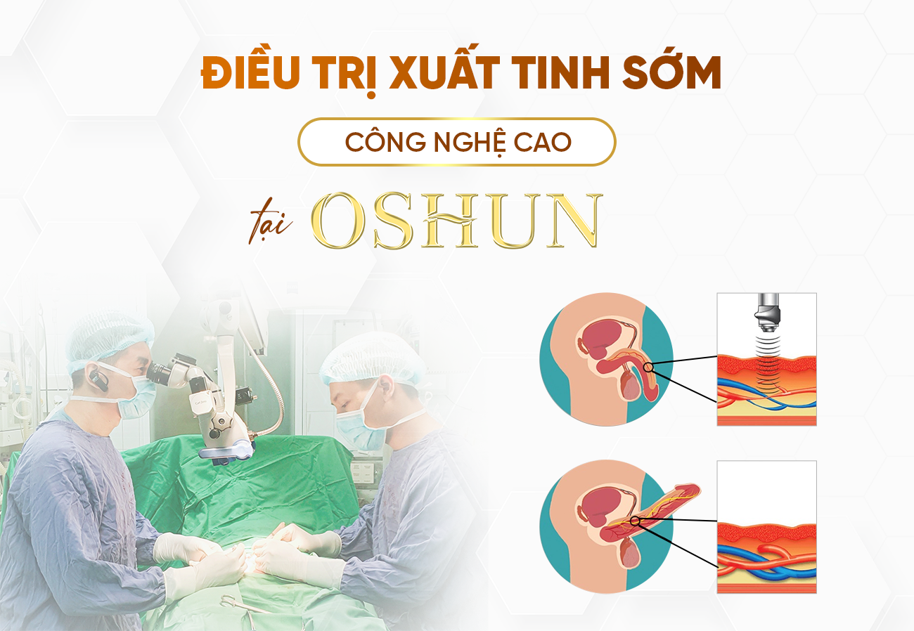 Điều Trị Xuất Tinh Sớm Công Nghệ Cao Tại Oshun