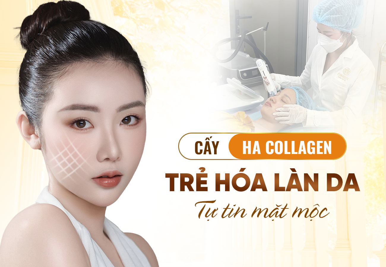 Tiêm Cấy HA Collagen Chuẩn Hàn