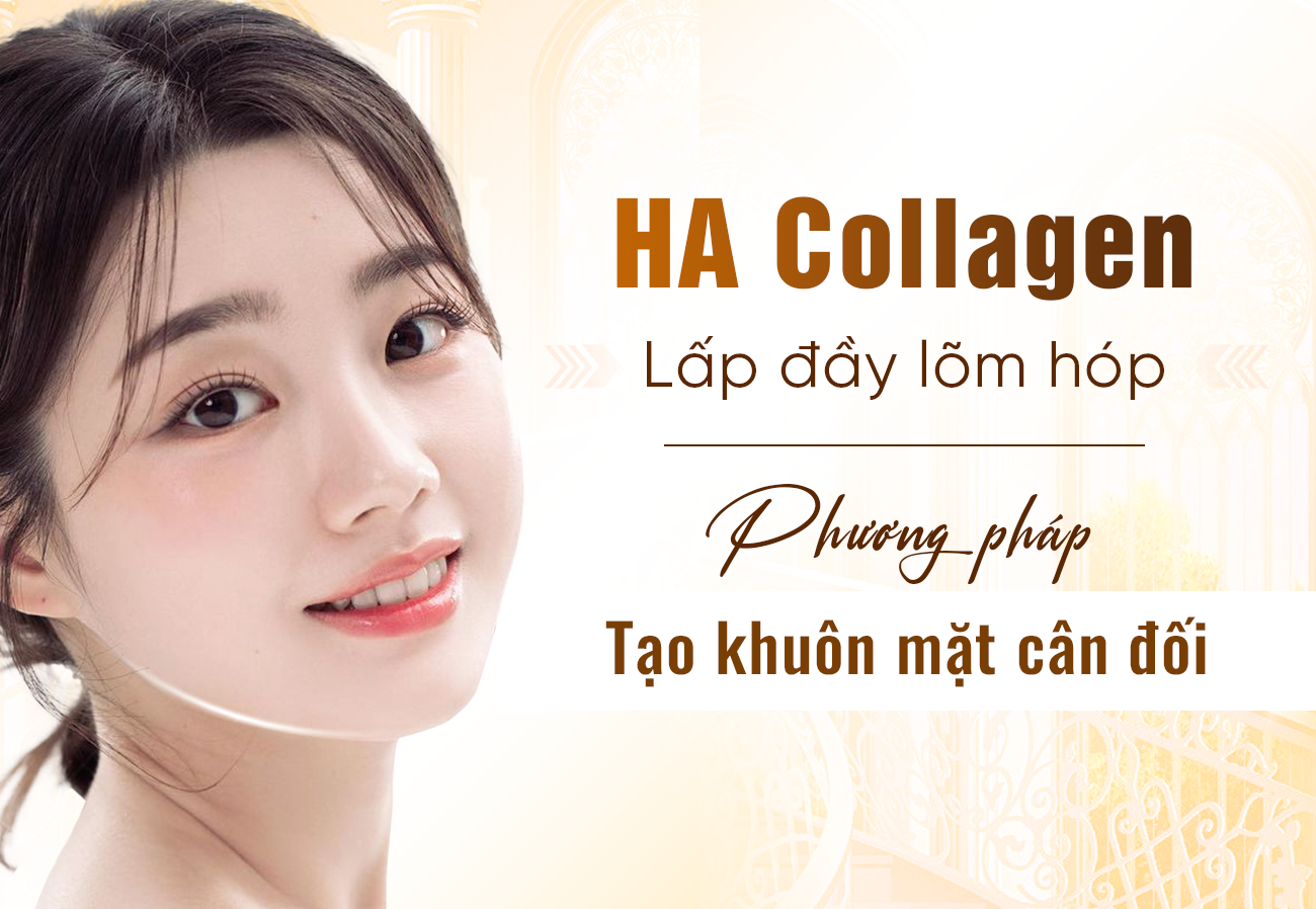 Cấy HA Collagen Làm Đầy Má Tại Oshun Beauty Clinic