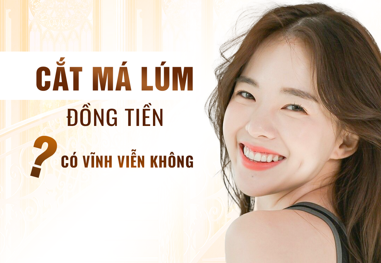 Cắt Má Lúm Đồng Tiền Có Vĩnh Viễn Không?