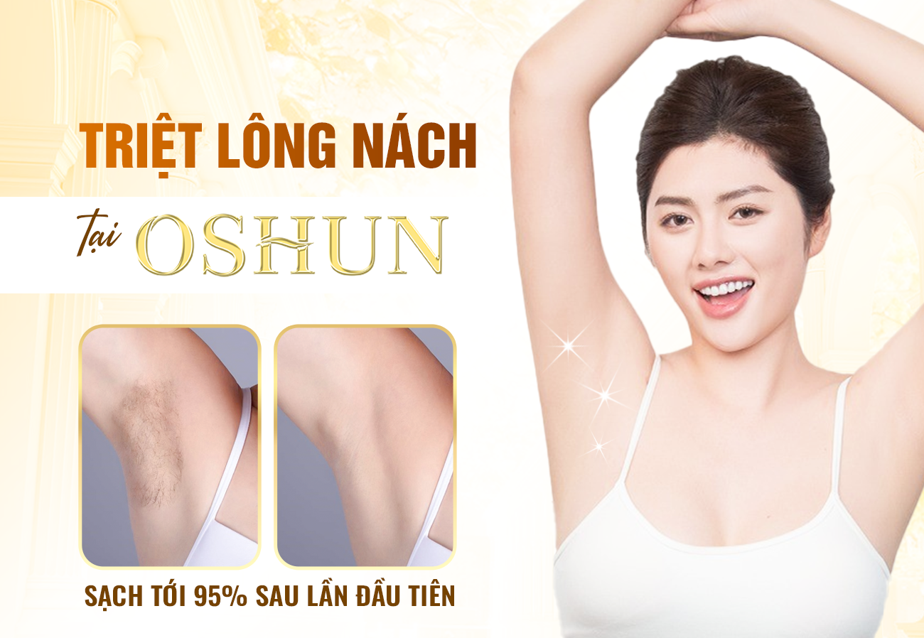 Triệt Lông Nách Tại Oshun Có Hết Vĩnh Viễn Không ?