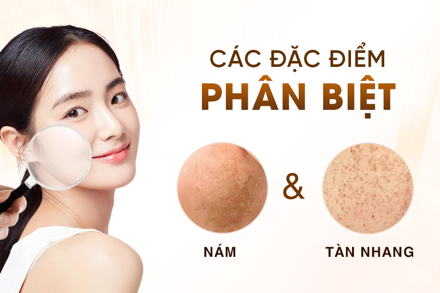 điều trị nám tận gốc