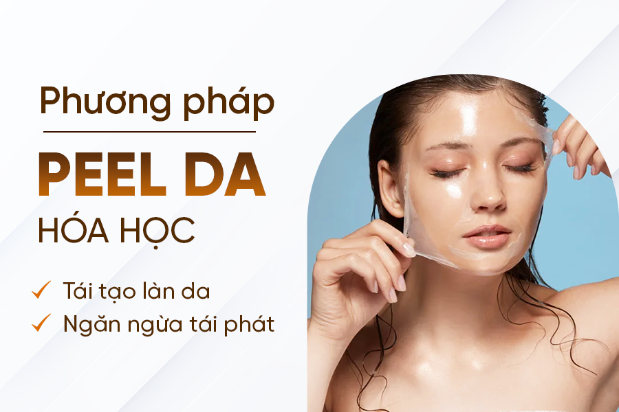 phương pháp peel da