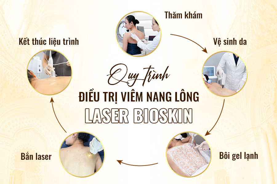 Điều Trị Viêm Nang Lông Bằng Laser Tại Oshun Biên Hòa