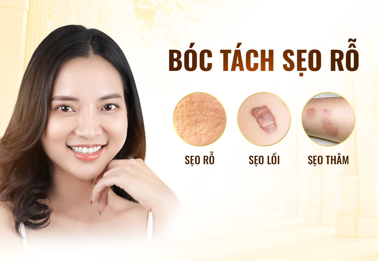 Bóc Tách Sẹo Rỗ Biên Hòa