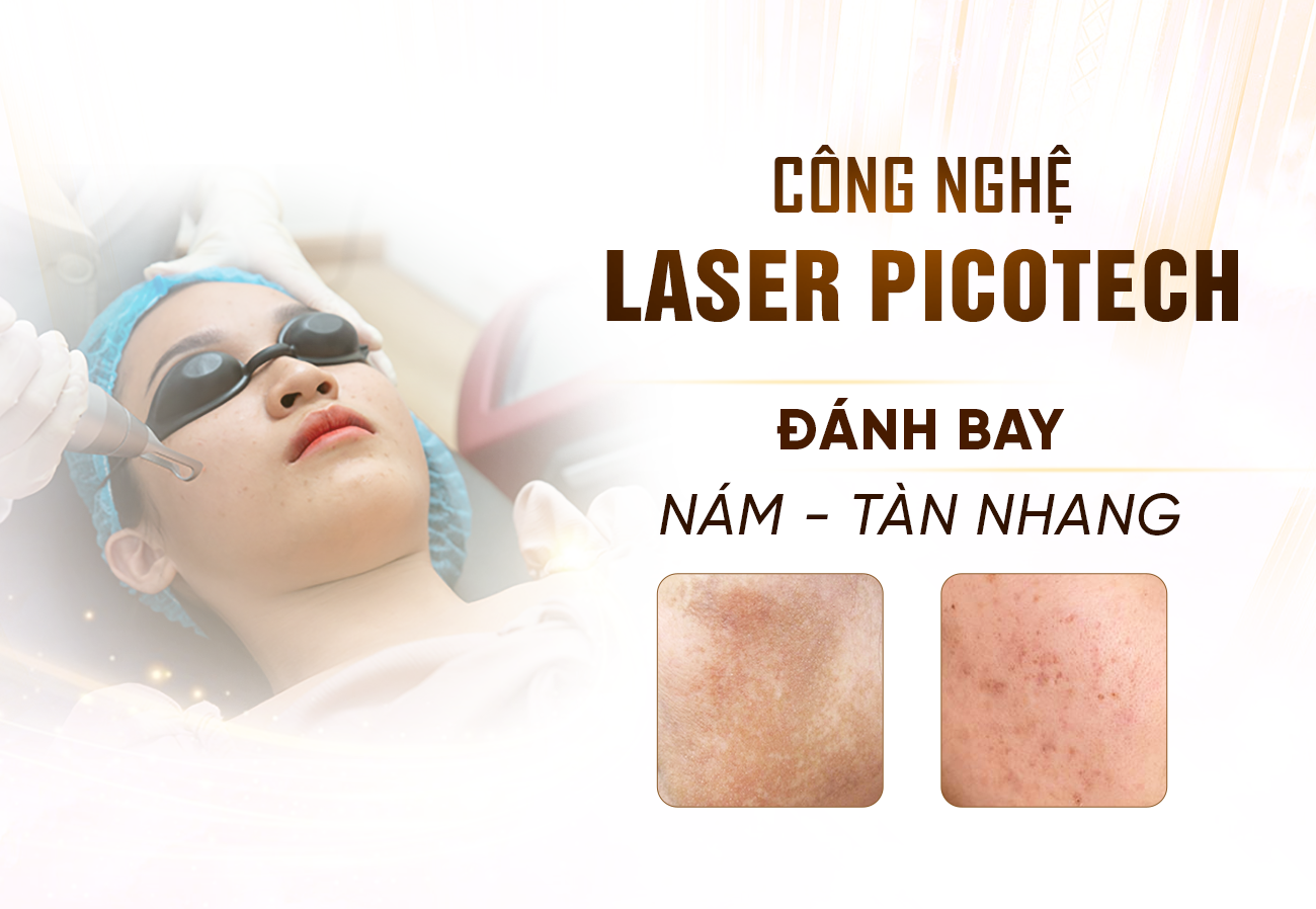 Laser Picotech Công Nghệ Điều Trị Nám Tàn Nhang