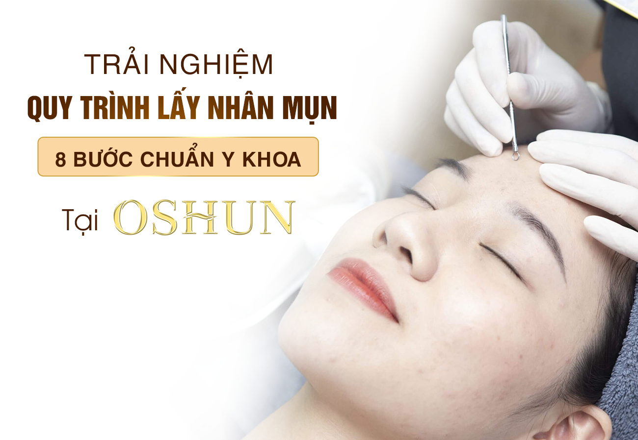 Lấy Nhân Mụn Chuẩn Y Khoa Cho Làn Da Sáng Mịn Tại Biên Hòa