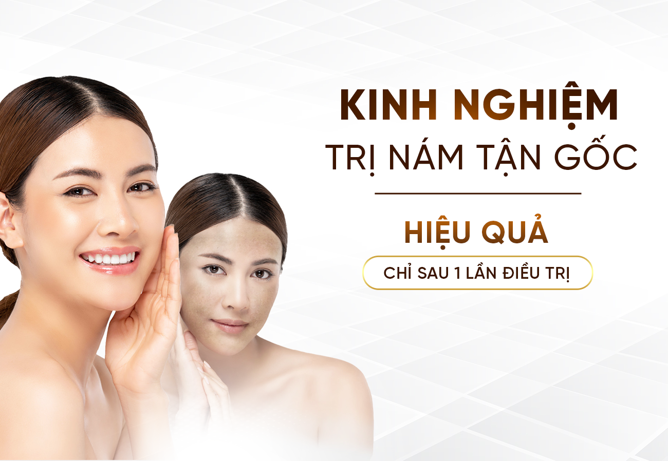 Điều Trị Nám Tận Gốc Hiệu Quả Tại Oshun Beauty Clinic