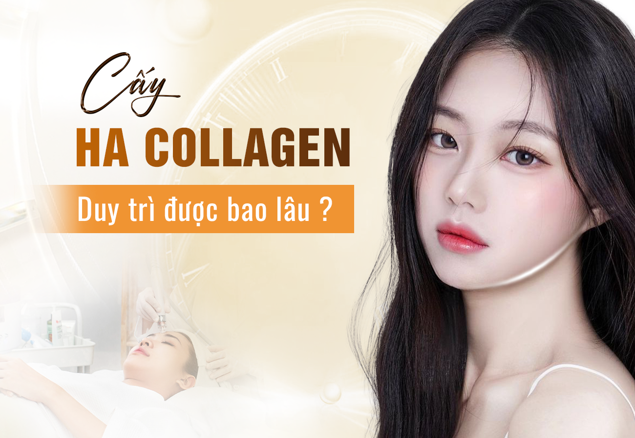 Cấy Ha Collagen Làm Đẹp Da Được Bao Lâu? 