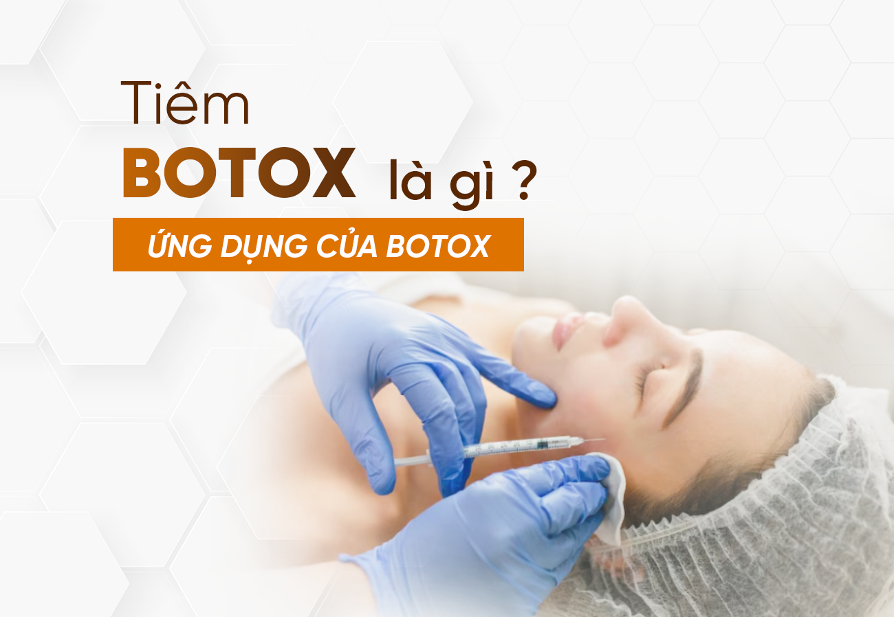 Tiêm Botox Là Gì? Ứng Dụng Của Tiêm Botox 