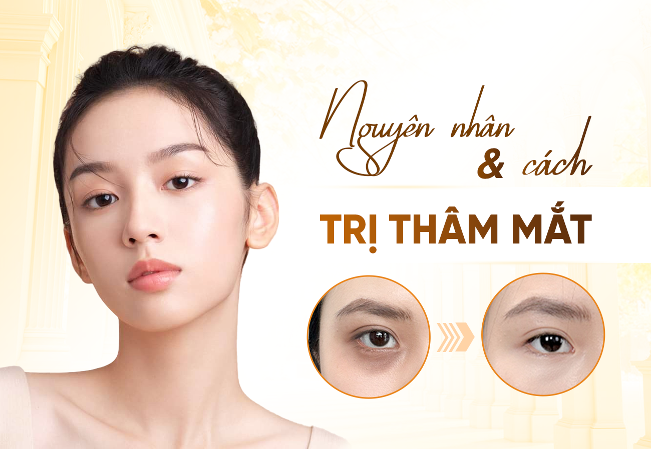 Cấy Tinh Chất Thâm Quầng Mắt 