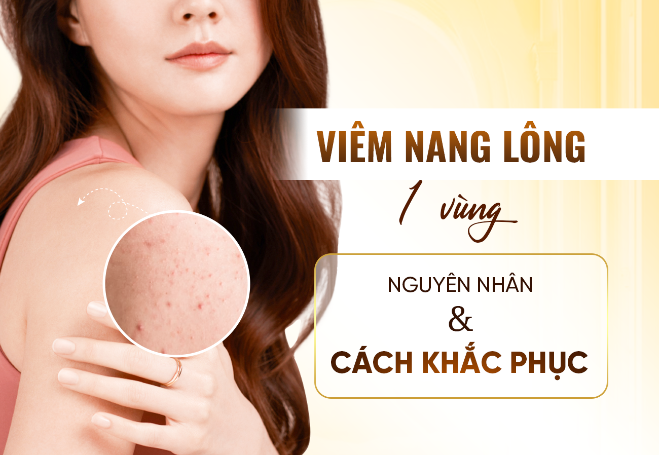 Điều Trị Viêm Nang Lông 1 Vùng: Cách Khắc Phục Nhanh Nhất