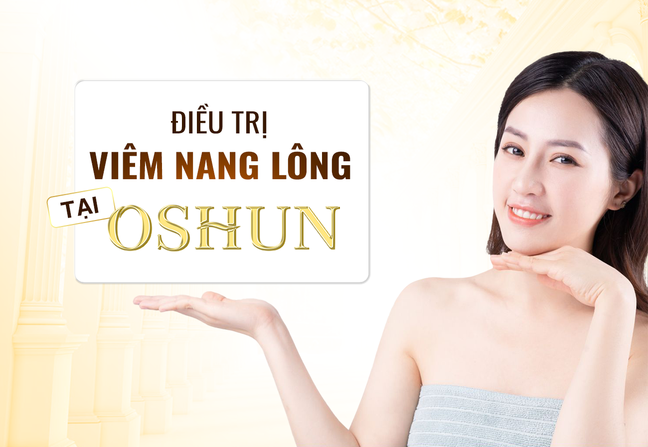 Điều Trị Viêm Nang Lông Tại Oshun Biên Hòa