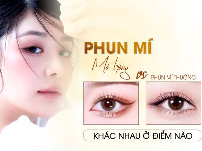 Phun Mí Mở Tròng Và Phun Mí Thường