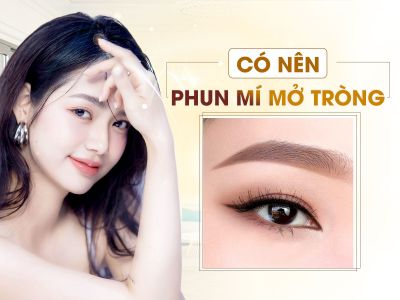 Có Nên Phun Mí Mở Tròng?