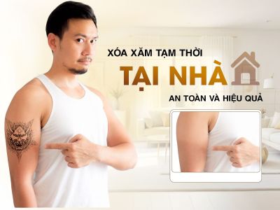 Xóa Hình Xăm Tạm Thời 