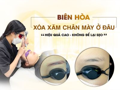 Xóa Xăm Chân Mày Không Để Lại Sẹo Tại Biên Hòa