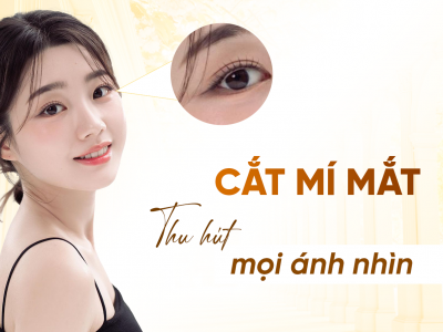 Cắt Mí Mắt Tại Oshun Biên Hòa