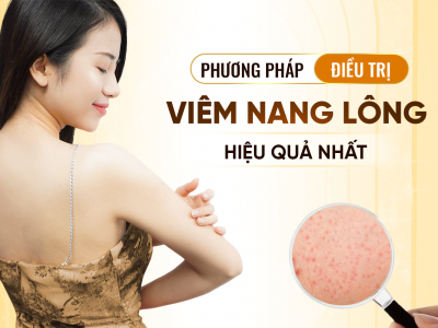 Phương Pháp Điều Trị Viêm Nang Lông Hiệu Quả Nhất 