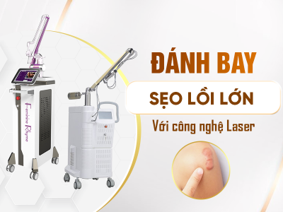 Liệu Trình Sẹo Lồi Lớn Với Công Nghệ Laser