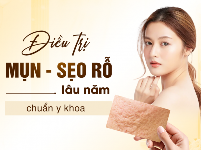 Điều Trị Sẹo Rỗ Ở Biên Hòa