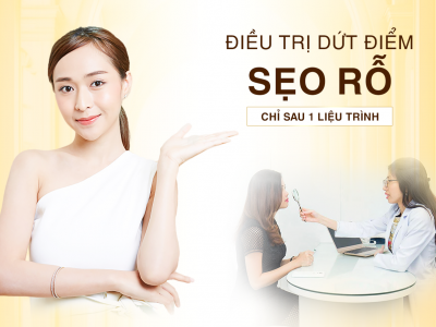 Điều Trị Sẹo Rỗ Hiệu Quả Nhất 