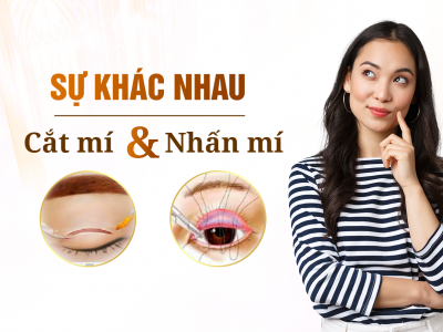 Nhấn Mí Và Cắt Mí Khác Nhau Như Thế Nào? 