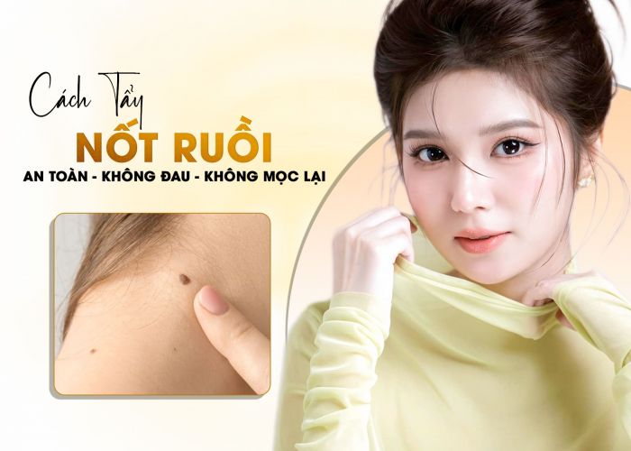 Cách tẩy nốt ruồi tại nhà hiệu quả và an toàn nhất