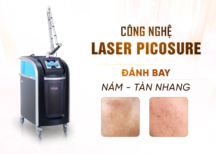 Điều Trị Nám Tàn Nhang Bằng Công Nghệ Laser Picosure Tại TMV Oshun