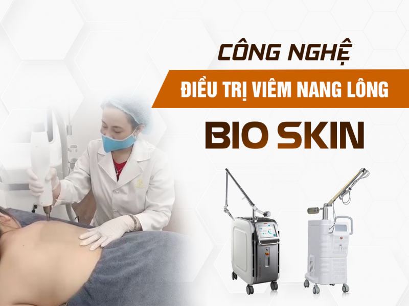 Điều Trị Viêm Nang Lông Bằng Laser Tại Oshun Biên Hòa