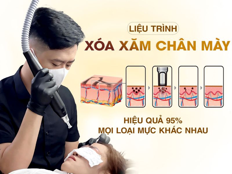 Liệu Trình Xóa Chân Mày