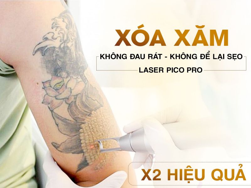 Xóa Xăm Bằng Laser