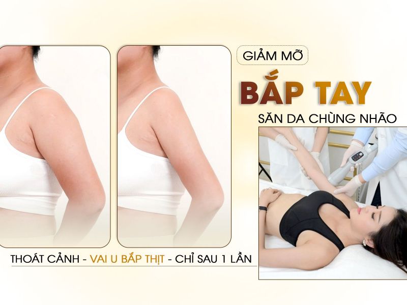 Giảm Béo Bắp Tay Công Nghệ Cao Tại Thẩm Mỹ Viện Oshun