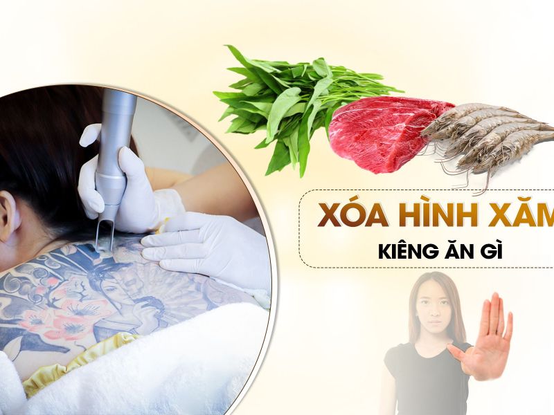 Xóa Hình Xăm Kiêng Ăn Gì Để Nhanh Phục Hồi