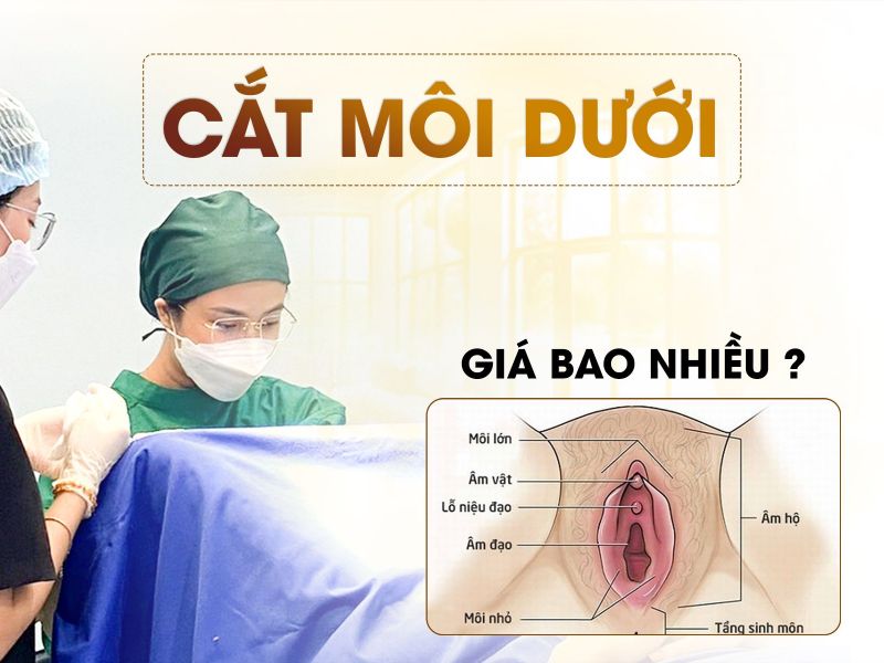 Cắt Môi Dưới Vùng Kín: Chi Phí Hợp Lý Là Bao Nhiêu?