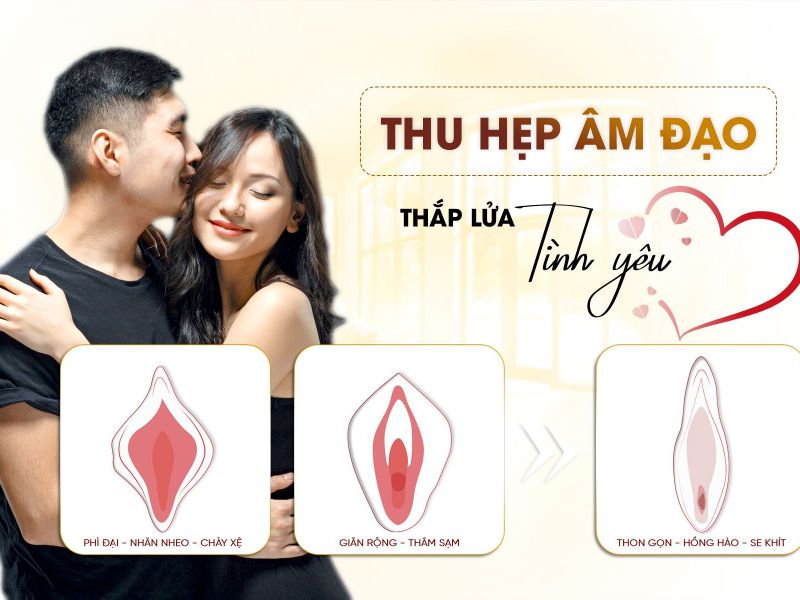 Thu Hẹp Âm Đạo Và Những Điều Bạn Cần Biết