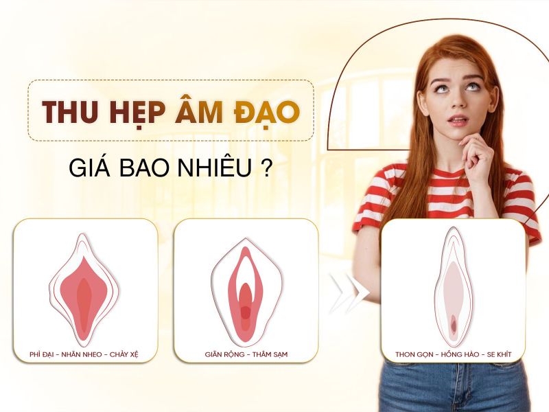 Thu Hẹp Âm Đạo Sự Lựa Chọn Hoàn Hảo Cho Sắc Đẹp Vùng Kín