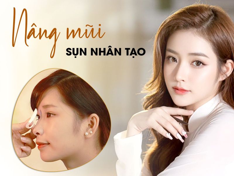 Nâng Mũi Sụn Nhân Tạo