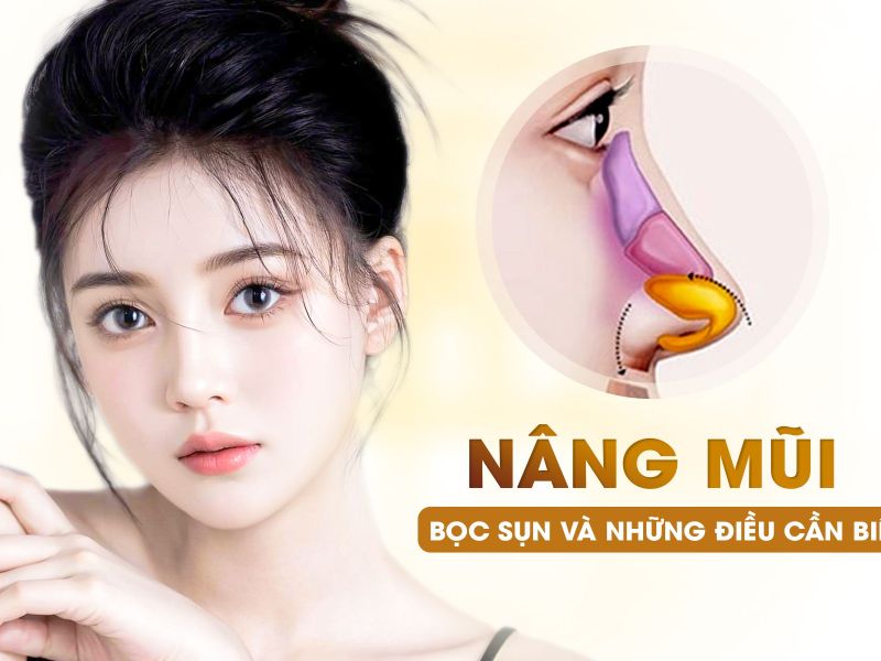 Nâng Mũi Bọc Sụn Giải Pháp Tối Ưu Để Có Dáng Mũi Đẹp