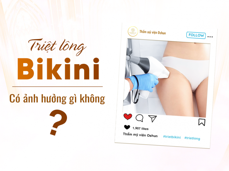 Triệt Lông Bikini Có Ảnh Hưởng Gì Tới Sức Khỏe Không?